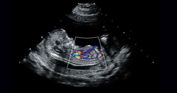 dr amar upadhyay fetal echo