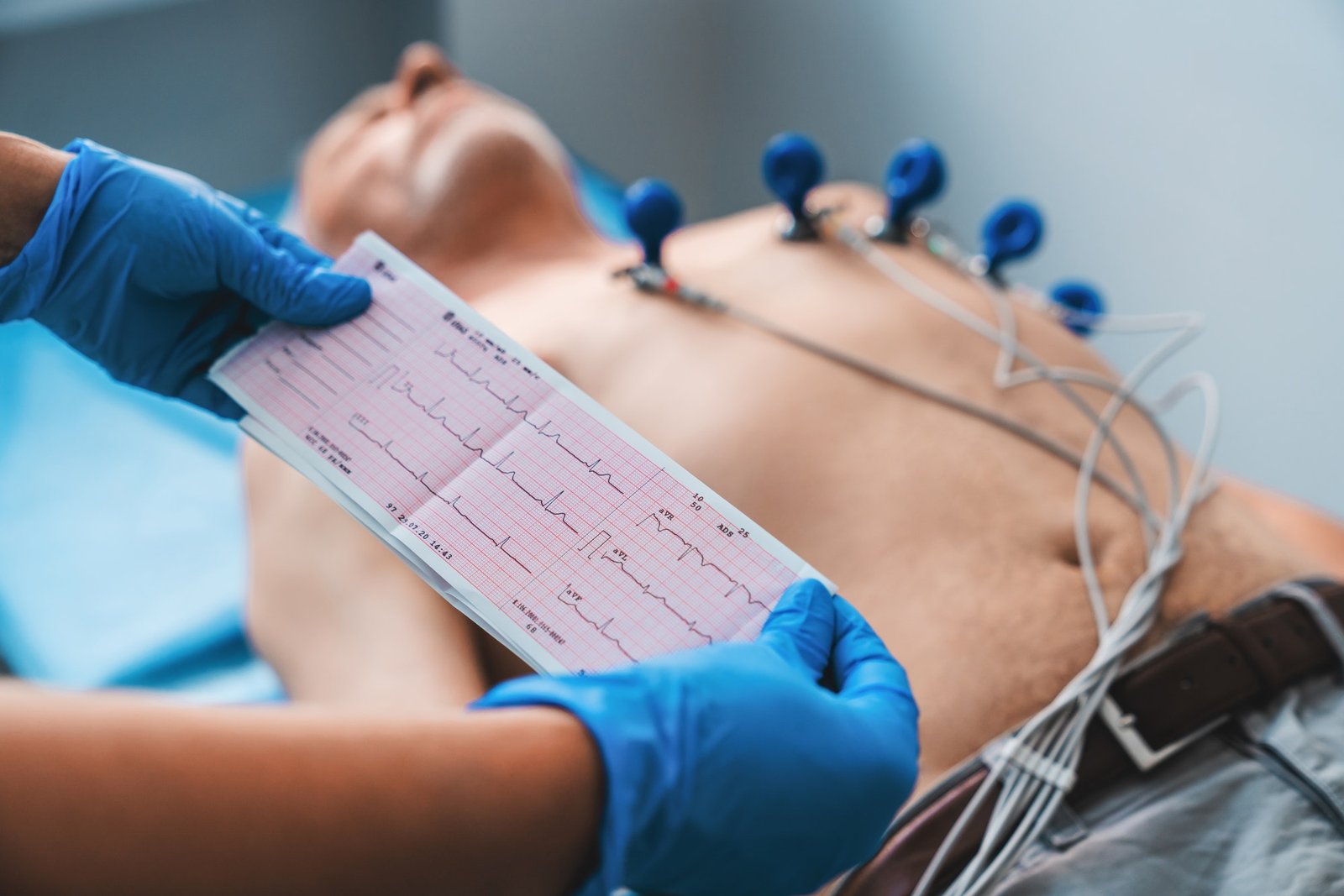 ECG Image