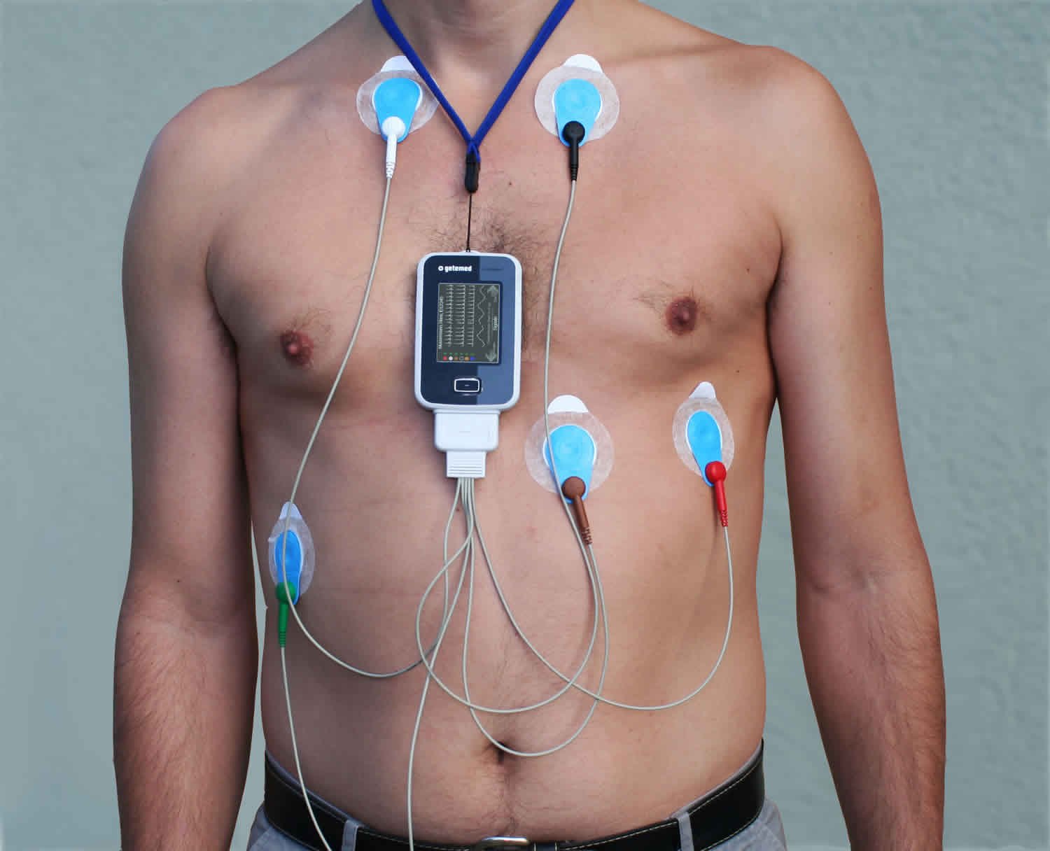 Holter Monitoring Image